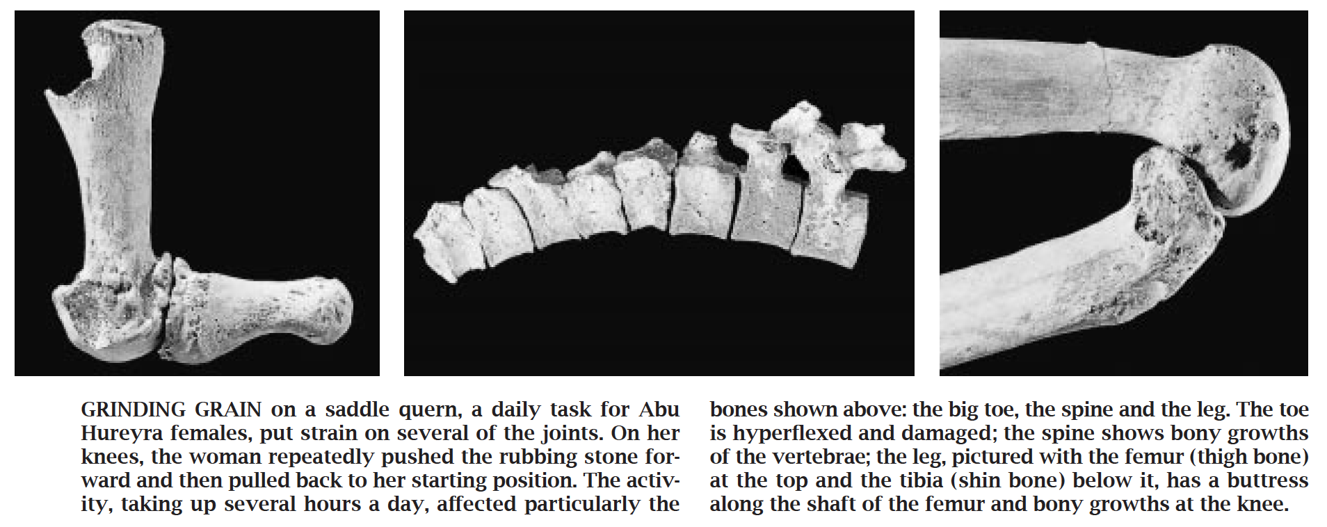 Bone wear from grinding grain