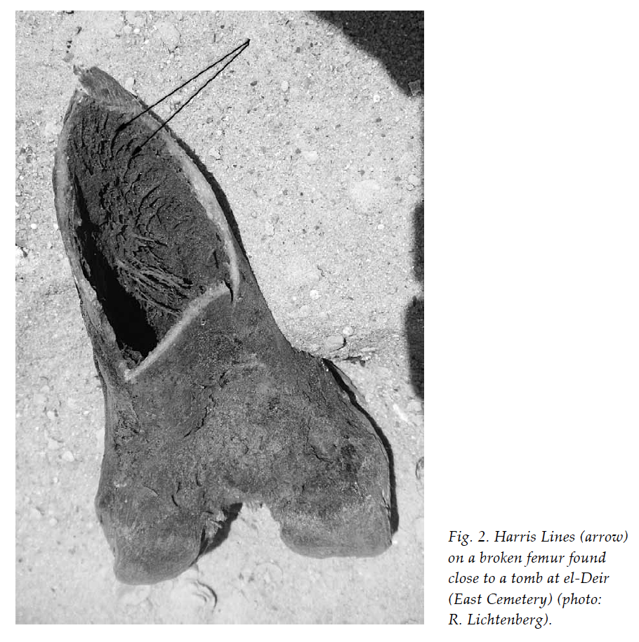 Portion of a bone